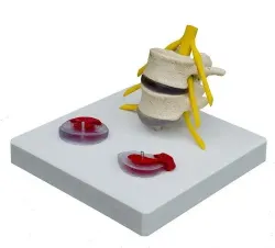 Skelet hernia model op statief [ A208] 