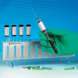 ESR Vakuumröhrchen ESR Vakuumröhrchen, Totaal: 2 ml, inclusief 0,4 ml gevulde NaCitraatoplossing ESR Vakuumröhrchen ESR Vakuumröhrchen, Totaal: 2 ml, inclusief 0,4 ml gevulde NaCitraatoplossing