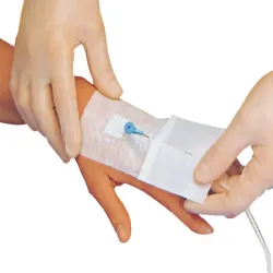 Applica I. V. 100 Smith & Nephew 8 x 6 cm