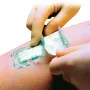 Opsite Post-operatieve ingreep Smith & Nephew 25 x 10 cm (20 x 5,7 cm verband)